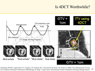 Is 4DCT Worthwhile?
Underberg, R.W.M., Lagerwaard, F.J., Cuijpers, J.P., Slotman, B.J., Van Sornsen de Koste, J.R.,Senan, S. (2004). Four-Dimensional CT Scan
s for Treatment Planning in Stereotactic Radiotherapy for Stage 1 Lung Cancer, International Journal of Radiation Oncology Biology Physics 27
 