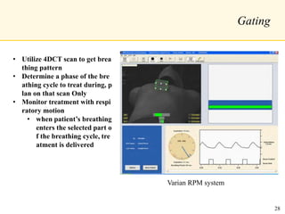 Gating
• Utilize 4DCT scan to get brea
thing pattern
• Determine a phase of the bre
athing cycle to treat during, p
lan on that scan Only
• Monitor treatment with respi
ratory motion
• when patient’s breathing
enters the selected part o
f the breathing cycle, tre
atment is delivered
Varian RPM system
28
 