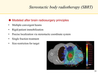 Stereotactic body radiotherapy (SBRT)
 Modeled after brain radiosurgery principles
• Multiple convergent beams
• Rigid patient immobilization
• Precise localization via stereotactic coordinate system
• Single fraction treatment
• Size-restriction for target
29
 