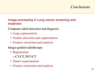 Conclusions
Image processing in Lung cancer screening and
treatment
Computer aided detection and diagnosis
• Lung segmentation
• Nodule detection and segmentation
• Feature extraction and analysis
Image-guided radiotherapy
• Registration
– CT/CT, PET/CT
• Tumor segmentation
• Feature extraction and analysis
49
 