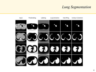 Lung Segmentation
6
 