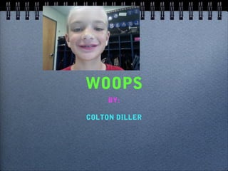 WOOPS
BY:
COLTON DILLER
 