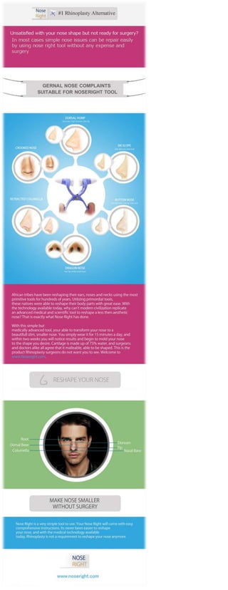 without surgery reshape your nose