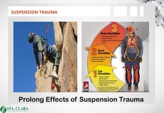 SUSPENSION TRAUMA
Prolong Effects of Suspension Trauma
 