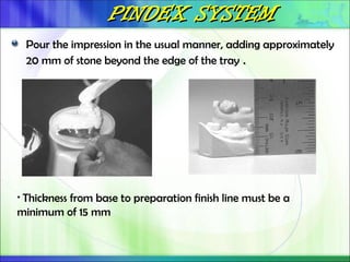 PINDEX SYSTEM
PINDEX SYSTEM
Pour the impression in the usual manner, adding approximately
20 mm of stone beyond the edge of the tray .
• Thickness from base to preparation finish line must be a
minimum of 15 mm
 