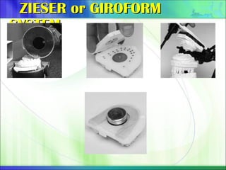 ZIESER or GIROFORM
ZIESER or GIROFORM
SYSTEM
SYSTEM
 
