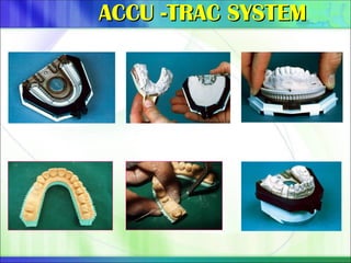 ACCU -TRAC SYSTEM
ACCU -TRAC SYSTEM
 
