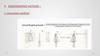 working length by different method dental | PPTX