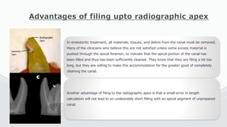 Advantages of filing upto radiographic apex
In endodontic treatment, all materials, tissues, and debris from the canal must be removed.
Many of the clinicians who believe this are not satisfied unless some excess material is
pushed through the apical foramen, to indicate that the apical portion of the canal has
been filled and thus has been sufficiently cleaned. They know that they are filing a bit too
long, but they are willing to make this accommodation for the greater good of completely
cleaning the canal.
Another advantage of filing to the radiographic apex is that a small error in length
calculation will not lead to an undesirably short filling with an apical segment of unprepared
canal.
 