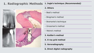 1. Radiographic Methods 1. Ingle’s technique (Recommended)
2. Others
– Best’s method
– Bregman’s method
– Bramante’s technique
– Grossman’s method
– Weine’s method
3. Kuttler’s method
4. X-ray grid method
5. Xeroradiography
6. Direct digital radiography
 
