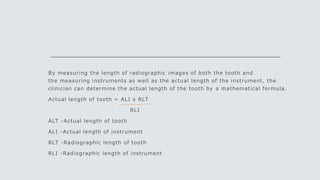 By measuring the length of radiographic images of both the tooth and
the measuring instruments as well as the actual length of the instrument, the
clinician can determine the actual length of the tooth by a mathematical formula.
Actual length of tooth = ALI x RLT
RLI
ALT -Actual length of tooth
ALI -Actual length of instrument
RLT -Radiographic length of tooth
RLI -Radiographic length of instrument
 