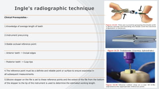 Ingle's radiographic technique
Clinical Prerequisites -
1.Knowledge of average length of teeth
2.Instrument precurving
3.Stable occlusal reference point:
– Anterior teeth → Incisal edges
– Posterior teeth → Cusp tips
4.The reference point must be a definite and reliable point or surface to ensure exactness in
all subsequent measurements.
5.Silicone stopper on the file is set to these reference points and the extent of the file from the bottom
of the stopper to the tip of the instrument is used to determine the estimated working length.
 