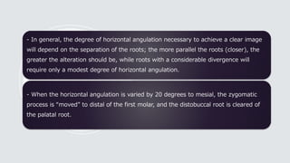 - In general, the degree of horizontal angulation necessary to achieve a clear image
will depend on the separation of the roots; the more parallel the roots (closer), the
greater the alteration should be, while roots with a considerable divergence will
require only a modest degree of horizontal angulation.
- When the horizontal angulation is varied by 20 degrees to mesial, the zygomatic
process is “moved” to distal of the first molar, and the distobuccal root is cleared of
the palatal root.
 