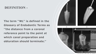 DEFINITION -
The term ‘‘WL’’ is defined in the
Glossary of Endodontic Terms as
‘‘the distance from a coronal
reference point to the point at
which canal preparation and
obturation should terminate.’’
 