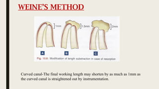 working length in endodontics , how to determine it | PPTX