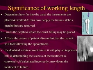 working length
