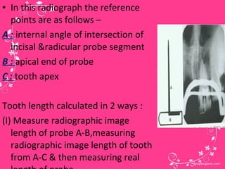 Working length determination | PPT