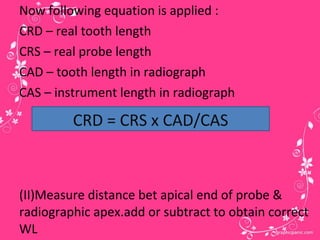 Working length determination | PPT