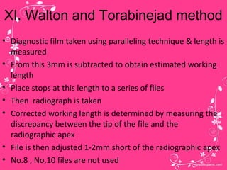 Working length determination | PPT