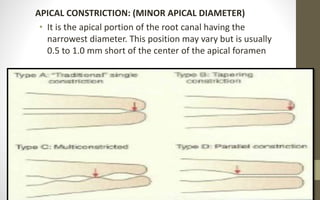 Working length determination | PPTX