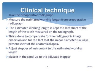 Endo Short Working Length Radiograph WORKING LENGTH DETERMINATION in endodontics-2.pptx