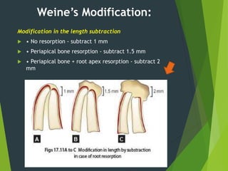 Working length determination | PPTX