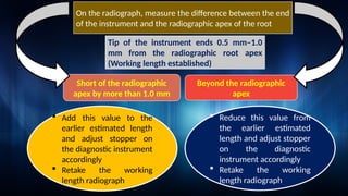 WORKING LENGTH DETERMINATION.pptx fir dental students | PPTX