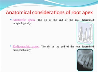 Working length determination and apex locator.ppt