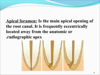 Working length determination | PPT