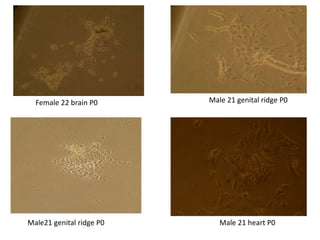Male21 genital ridge P0
Female 22 brain P0 Male 21 genital ridge P0
Male 21 heart P0
 