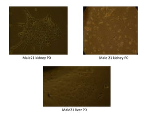 Male21 kidney P0 Male 21 kidney P0
Male21 liver P0
 
