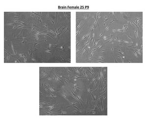 Brain Female 25 P9
 