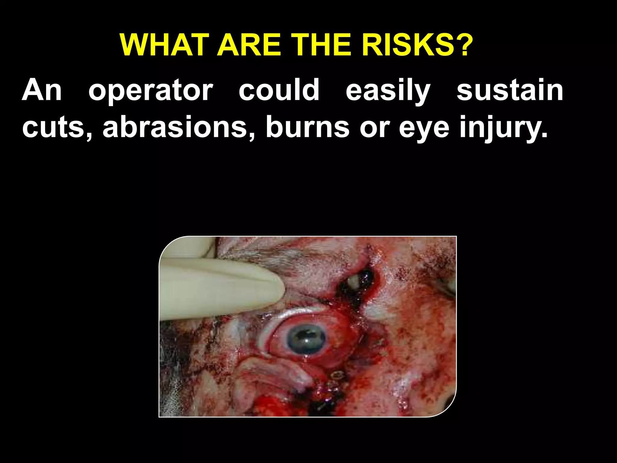WHAT ARE THE RISKS?
An operator could easily sustain
cuts, abrasions, burns or eye injury.
 