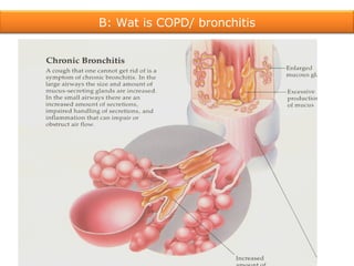 B: Wat is COPD/ bronchitis 