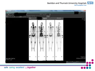 Palliative Care and Acute Oncology Integration | PDF