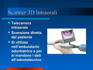 Scanner 3D IntraoraliScanner 3D Intraorali
 Telecamera
intraorale
 Scansione diretta
del paziente
 Si utilizza
nell’ambulatorio
odontiatrico e poi
si mandano i dati
all’odontotecnico
 