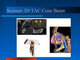 Scanner 3D TAC Cone BeamScanner 3D TAC Cone Beam
 