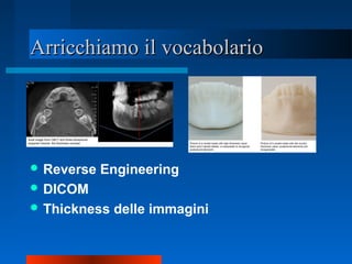 Arricchiamo il vocabolarioArricchiamo il vocabolario
 Reverse Engineering
 DICOM
 Thickness delle immagini
 