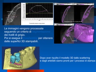 Le immagini vengono processate
seguendo un criterio di segmentazione
dei livelli di grigio.
Poi si esegue il thresholding per ottenere
delle superfici 3D stampabili.
Dopo aver ripulito il modello 3D dallo scattering
e dagli artefatti siamo pronti per i processi di stampa
 