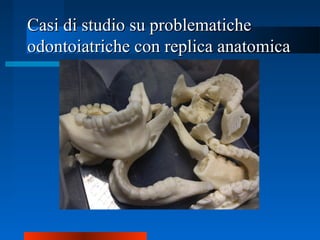 Casi di studio su problematicheCasi di studio su problematiche
odontoiatriche con replica anatomicaodontoiatriche con replica anatomica
 