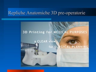 Repliche Anatomiche 3D pre-operatorieRepliche Anatomiche 3D pre-operatorie
 