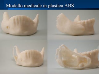 Modello medicale in plastica ABSModello medicale in plastica ABS
 