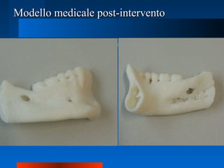 Modello medicale post-interventoModello medicale post-intervento
 