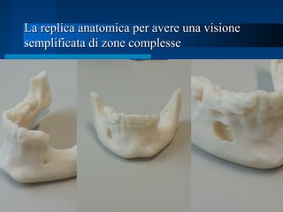 La replica anatomica per avere una visioneLa replica anatomica per avere una visione
semplificata di zone complessesemplificata di zone complesse
 