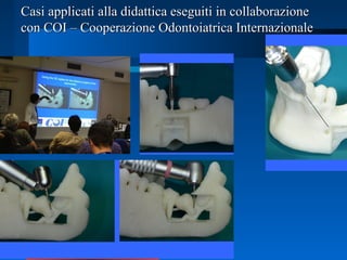Casi applicati alla didattica eseguiti in collaborazioneCasi applicati alla didattica eseguiti in collaborazione
con COI – Cooperazione Odontoiatrica Internazionalecon COI – Cooperazione Odontoiatrica Internazionale
 