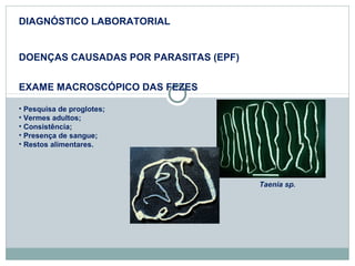 DIAGNÓSTICO LABORATORIAL 
DOENÇAS CAUSADAS POR PARASITAS (EPF) 
EXAME MACROSCÓPICO DAS FEZES 
• Pesquisa de proglotes; 
• Vermes adultos; 
• Consistência; 
• Presença de sangue; 
• Restos alimentares. 
Taenia sp. 
 