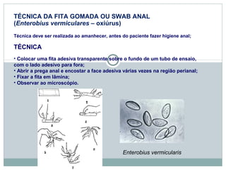 TÉCNICA DA FITA GOMADA OU SWAB ANAL 
(Enterobius vermiculares – oxiúrus) 
Técnica deve ser realizada ao amanhecer, antes do paciente fazer higiene anal; 
TÉCNICA 
• Colocar uma fita adesiva transparente sobre o fundo de um tubo de ensaio, 
com o lado adesivo para fora; 
• Abrir a prega anal e encostar a face adesiva várias vezes na região perianal; 
• Fixar a fita em lâmina; 
• Observar ao microscópio. 
Enterobius vermicularis 
 