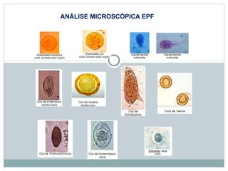 ANÁLISE MICROSCÓPICA EPF 
 
