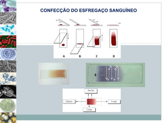 CONFECÇÃO DO ESFREGAÇO SANGUÍNEO 
 