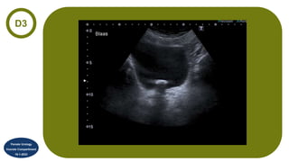 D3
Female Urology
Voorste Compartiment
19-1-2023
 